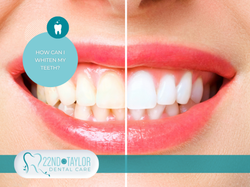 How Can I Whiten My Teeth?