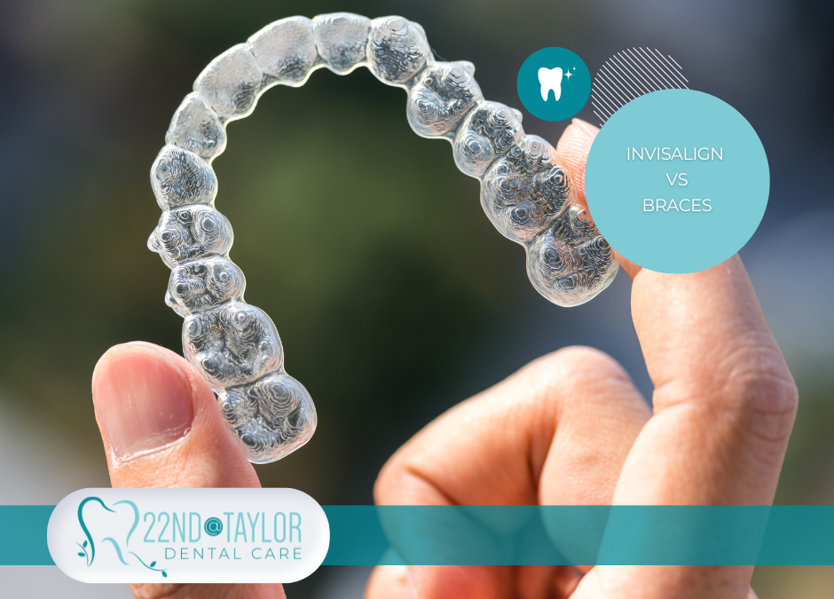 Invisalign Vs. Braces: Which is Right for You?