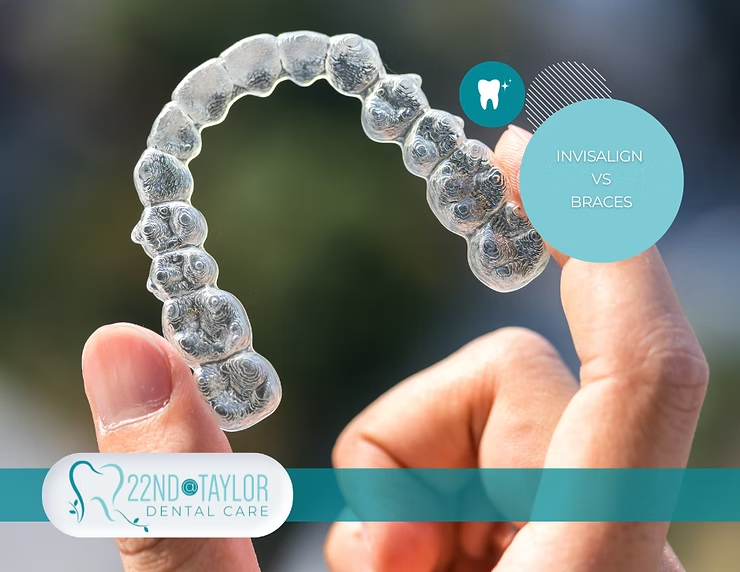 Invisalign Vs. Braces: Which is Right for You?