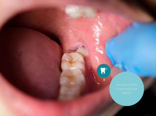 Your Dentist in Red Deer for Wisdom Tooth Extraction | 22nd @ Taylor