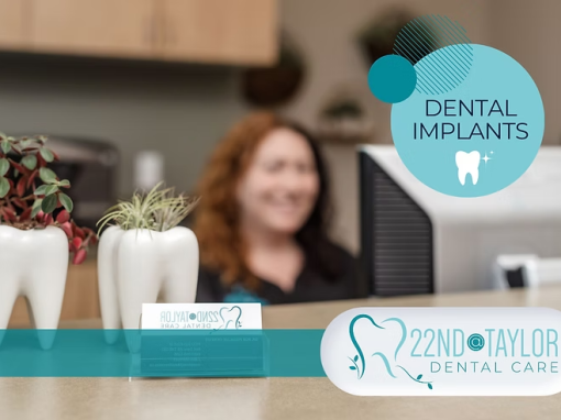 Dental Implants: The Ultimate Tooth Replacement Solution