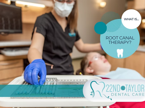 Root Canal Therapy| 22nd @ Taylor Dental Care