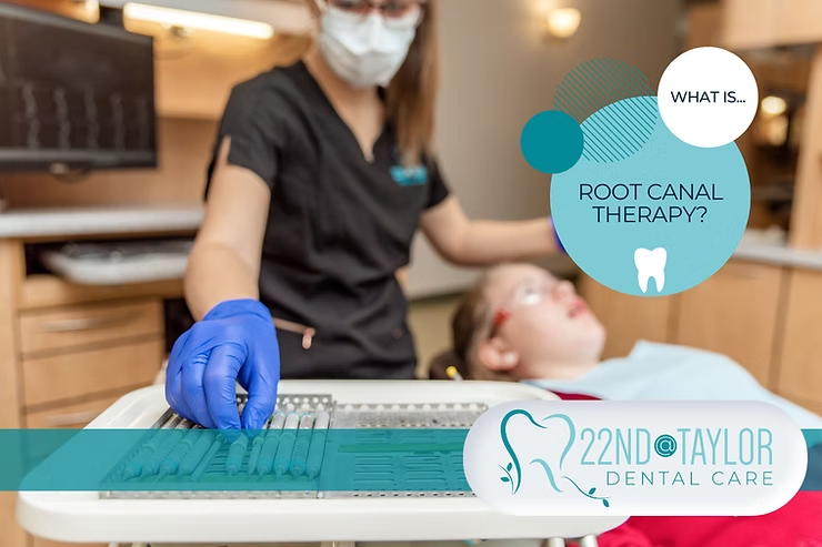 Root Canal Therapy| 22nd @ Taylor Dental Care